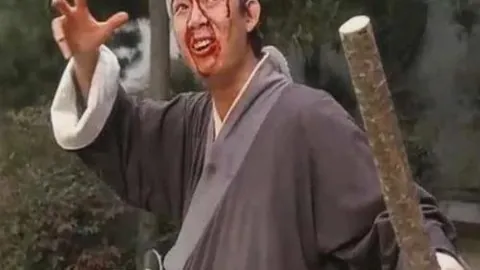 安东尼戴维斯伤愈进展，复出不远在即